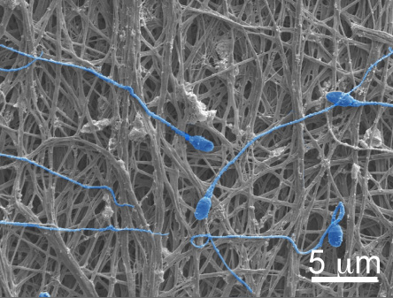 electric-spun-fiber-sperm-condom